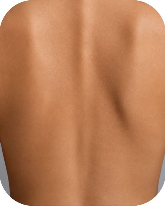 Back